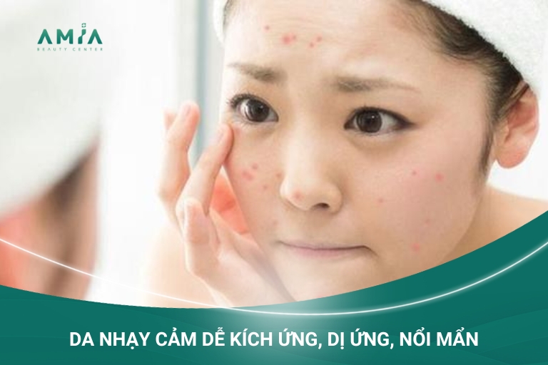 Dễ dàng nhận biết da nhạy cảm với các biểu hiện bên ngoài