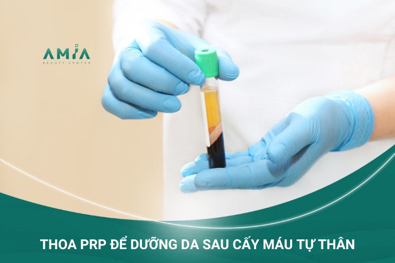 Thoa PRP để chăm sóc, phục hồi da tốt nhất