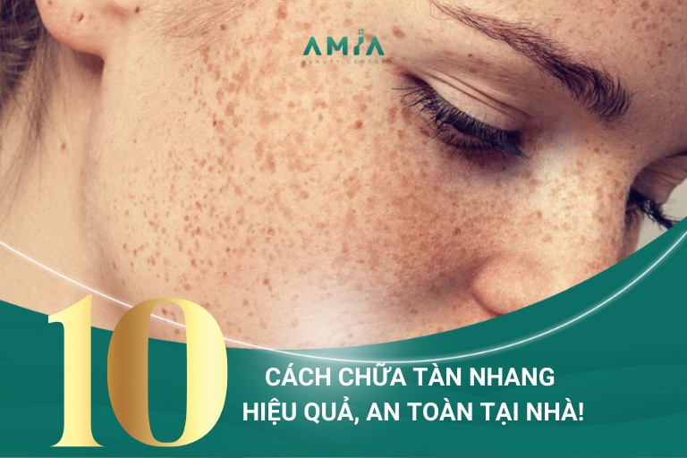 10+ Cách Chữa Tàn Nhang Hiệu Quả An Toàn Tại Nhà!