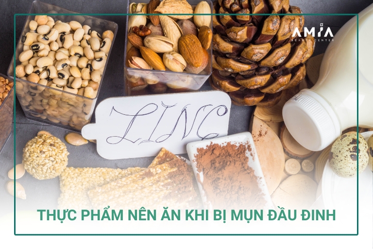 Thực phẩm nên ăn khi bị mụn đầu đinh