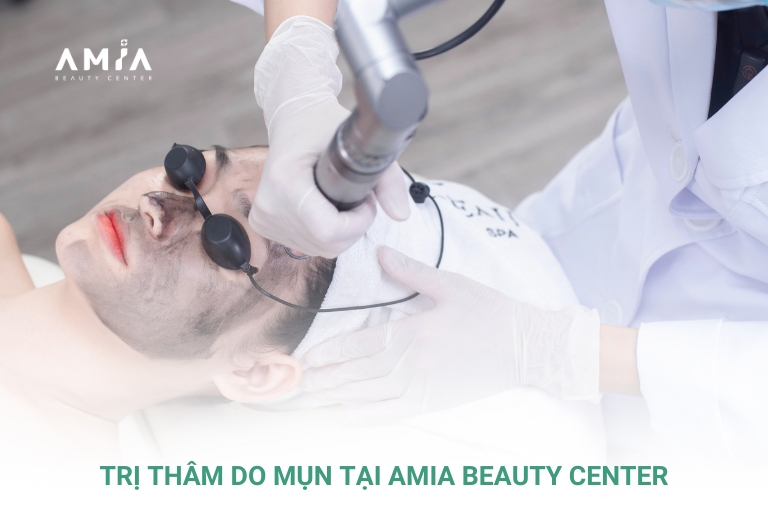 Trị thâm mụn với công nghệ cao hiện đại tại Amia Beauty Center