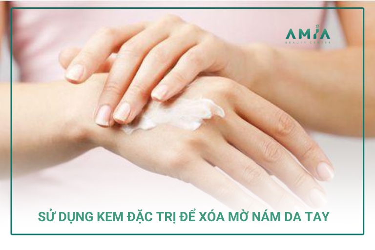 Cách trị nám da tay tiện dụng đó là dùng kem bôi đặc trị