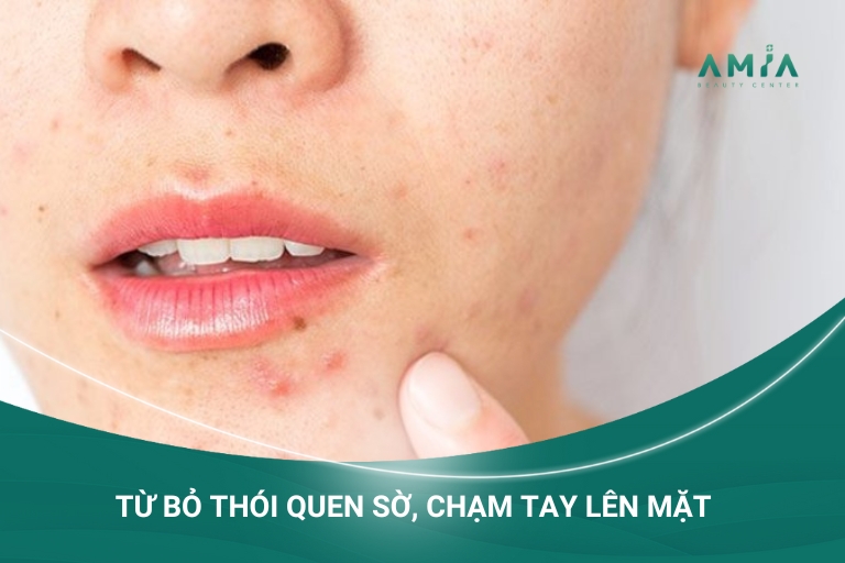 Để chăm sóc da sau khi Purging cần phải từ bỏ thói quen chạm tay lên mặt, tránh mụn bùng phát mạnh hơn