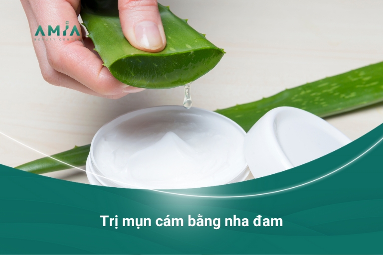 Điều trị mụn cám tại nhà