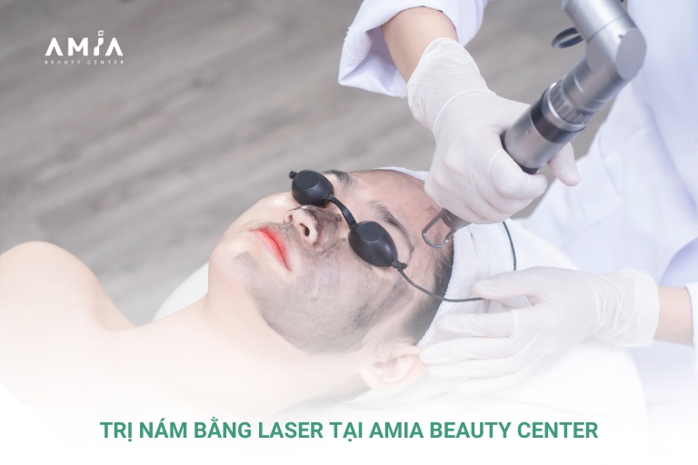 Trị nám da mặt với laser tại Amia Beauty Center