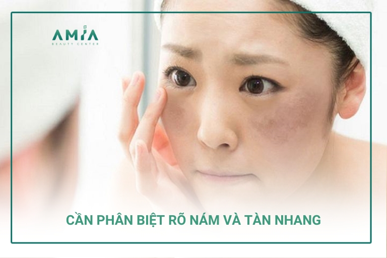 Phân biệt rõ nám và tàn nhang để có hướng điều trị phù hợp