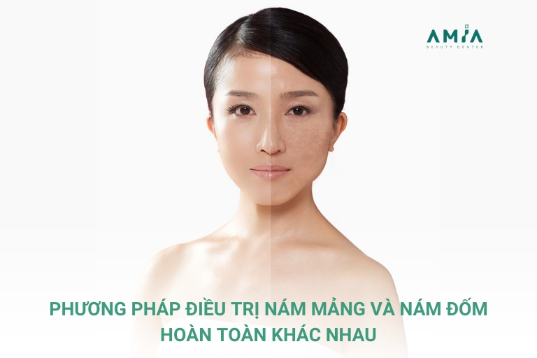 Chữa nám mảng và nám đốm sẽ có từng liệu trình điều trị phù hợp