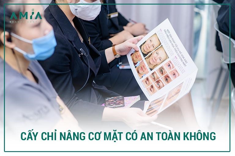 Nâng cơ mặt bằng chỉ collagen