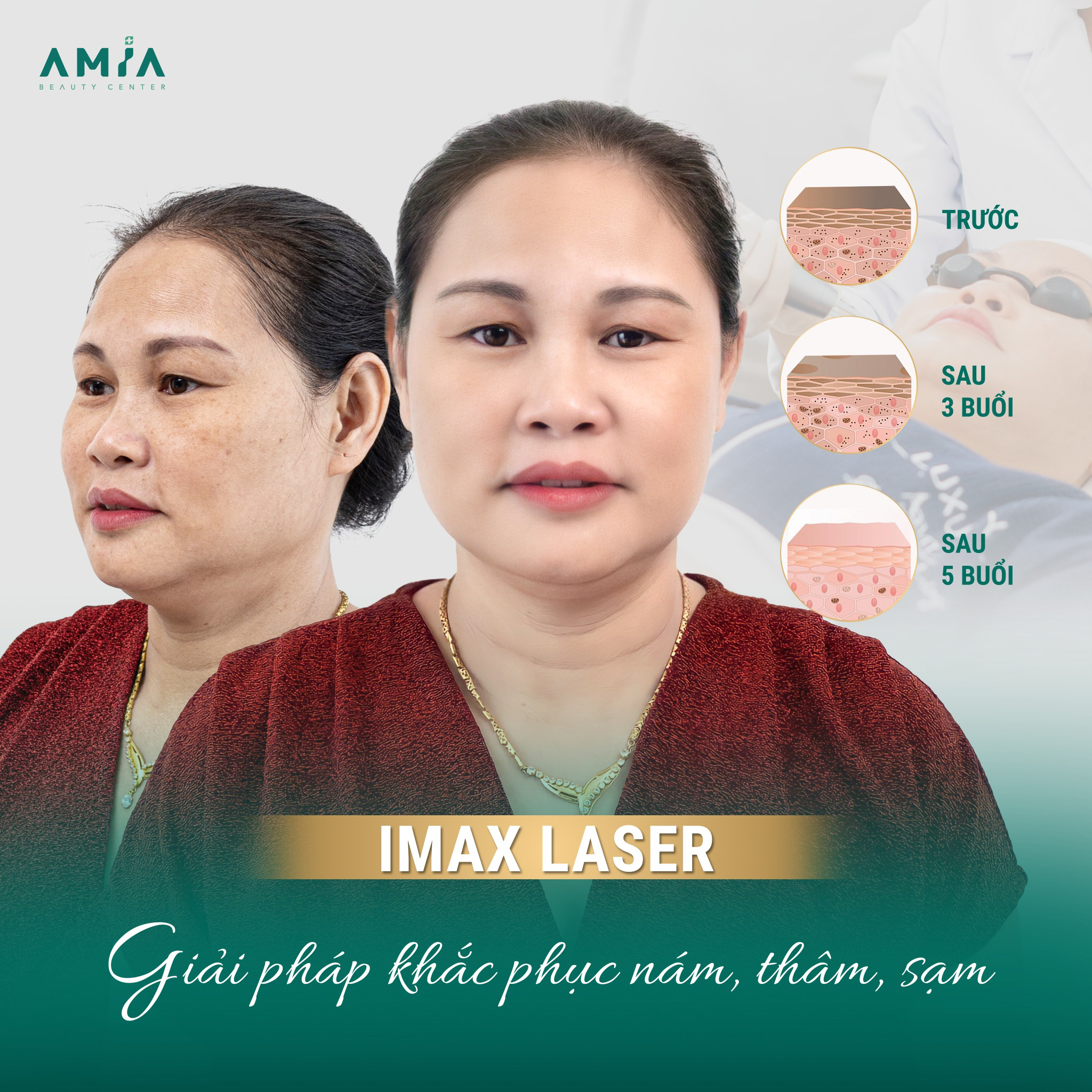 Điều trị nám chân sâu IMAX Laser mang tới hiệu quả rõ rệt sau một liệu trình