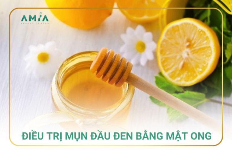 Điều trị mụn đầu đen bằng mật ong 