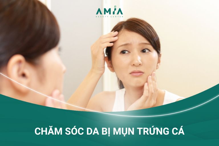 cách chăm sóc da bị mụn trứng cá