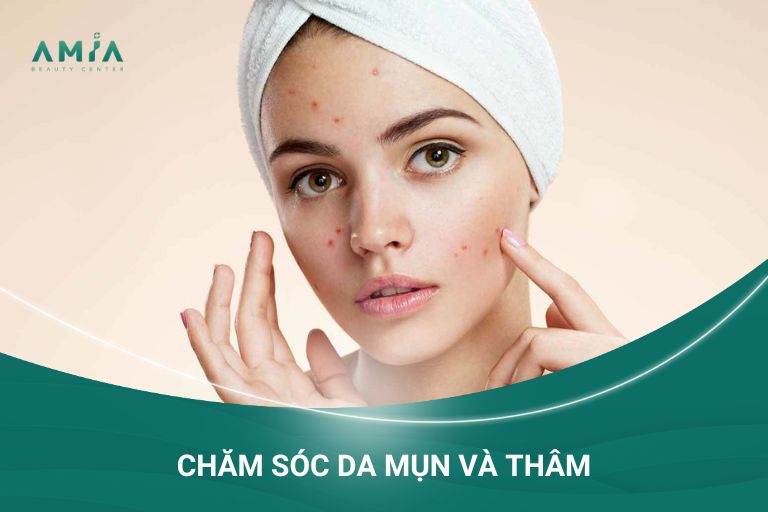 Chăm sóc da mụn và thâm