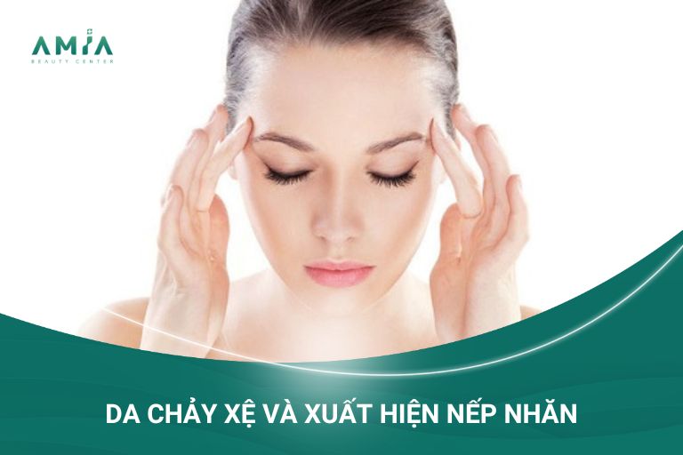 Da chảy xệ và nhiều nếp nhăn