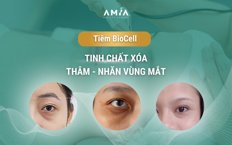 BioCell là giải pháp tiêm xóa nhăn thâm vùng mắt an toàn hiệu quả