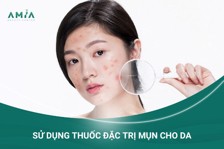 Điều trị bằng các loại thuốc đặc trị