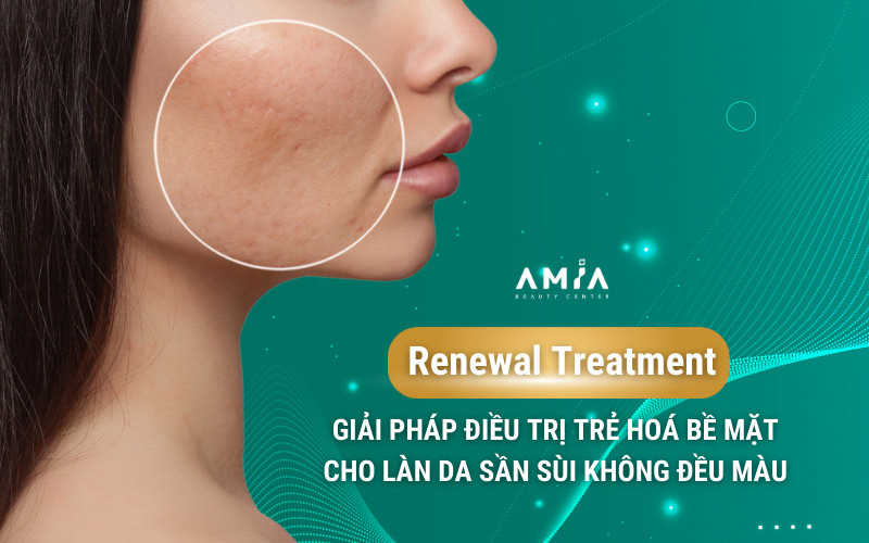 trẻ hóa Renewal Treatment là giải pháp điều trị dày sừng nang lông, da không đều màu,...