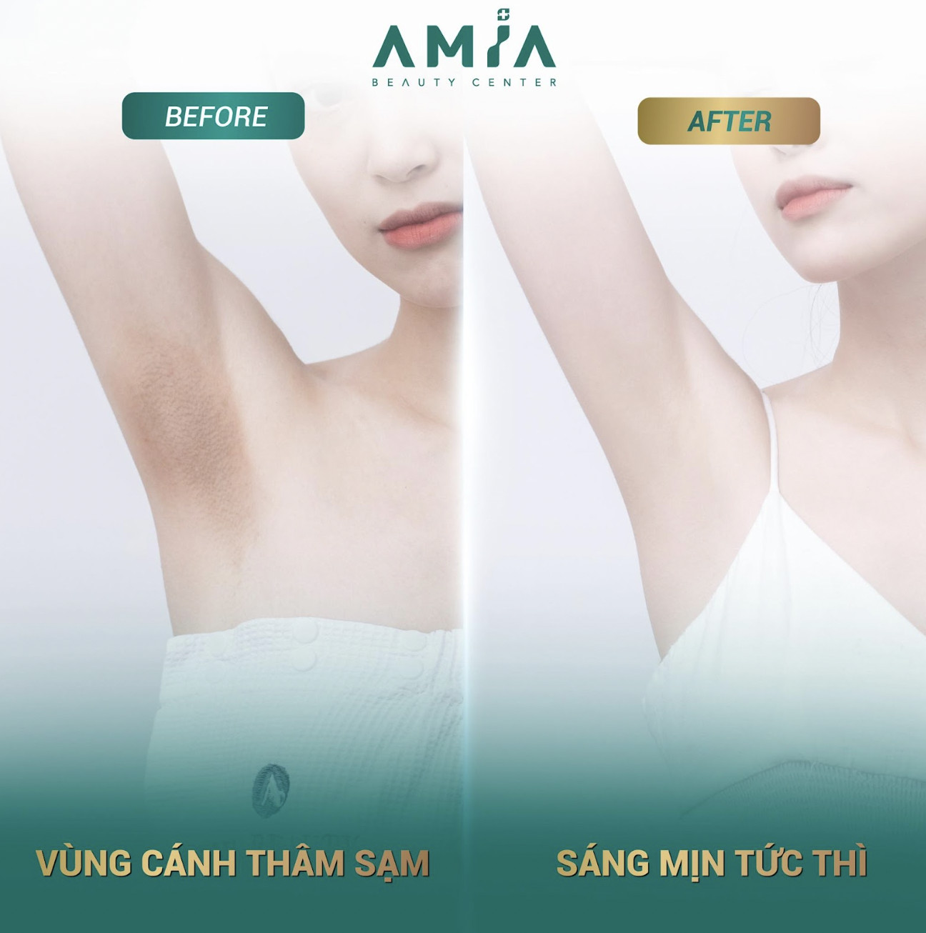 Hiệu quả trị thâm vùng cánh