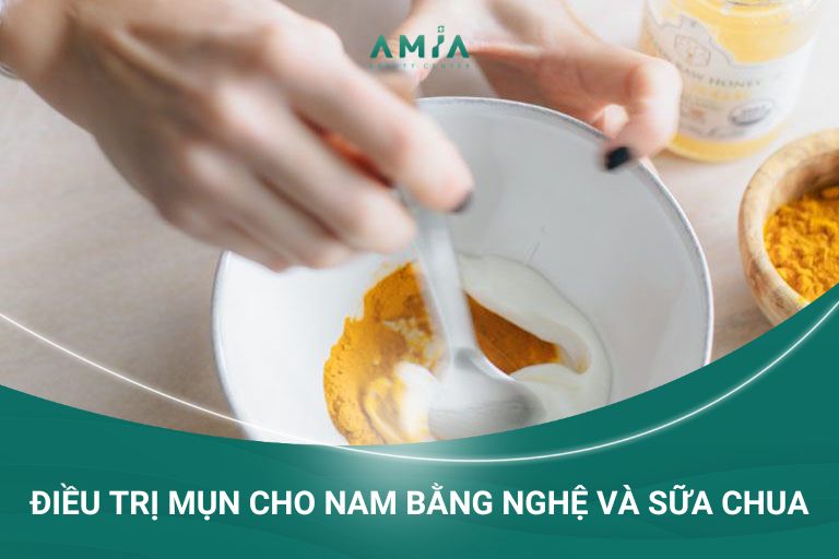 Điều trị mụn cho nam bằng nghệ và sữa chua