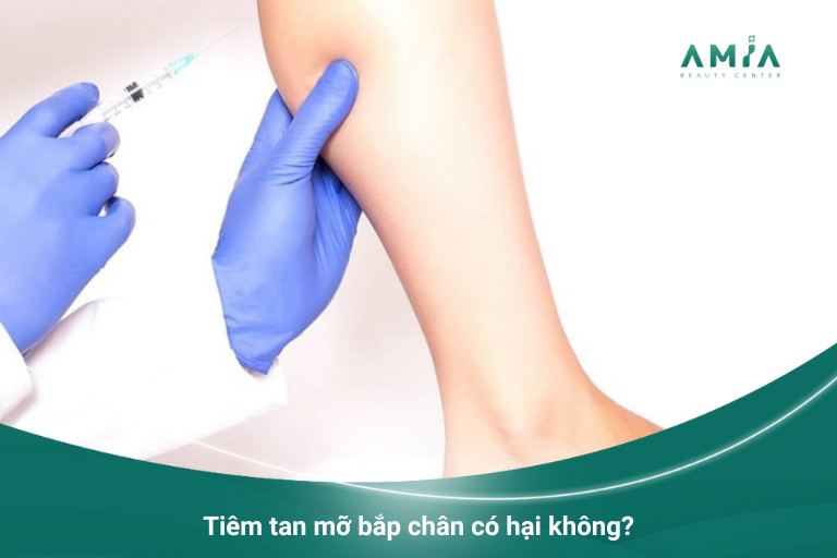 Tiêm giảm mỡ bắp chân đảm bảo an toàn khi thực hiện tại địa chỉ uy tín, có bác sĩ giỏi và dùng thuốc chất lượng