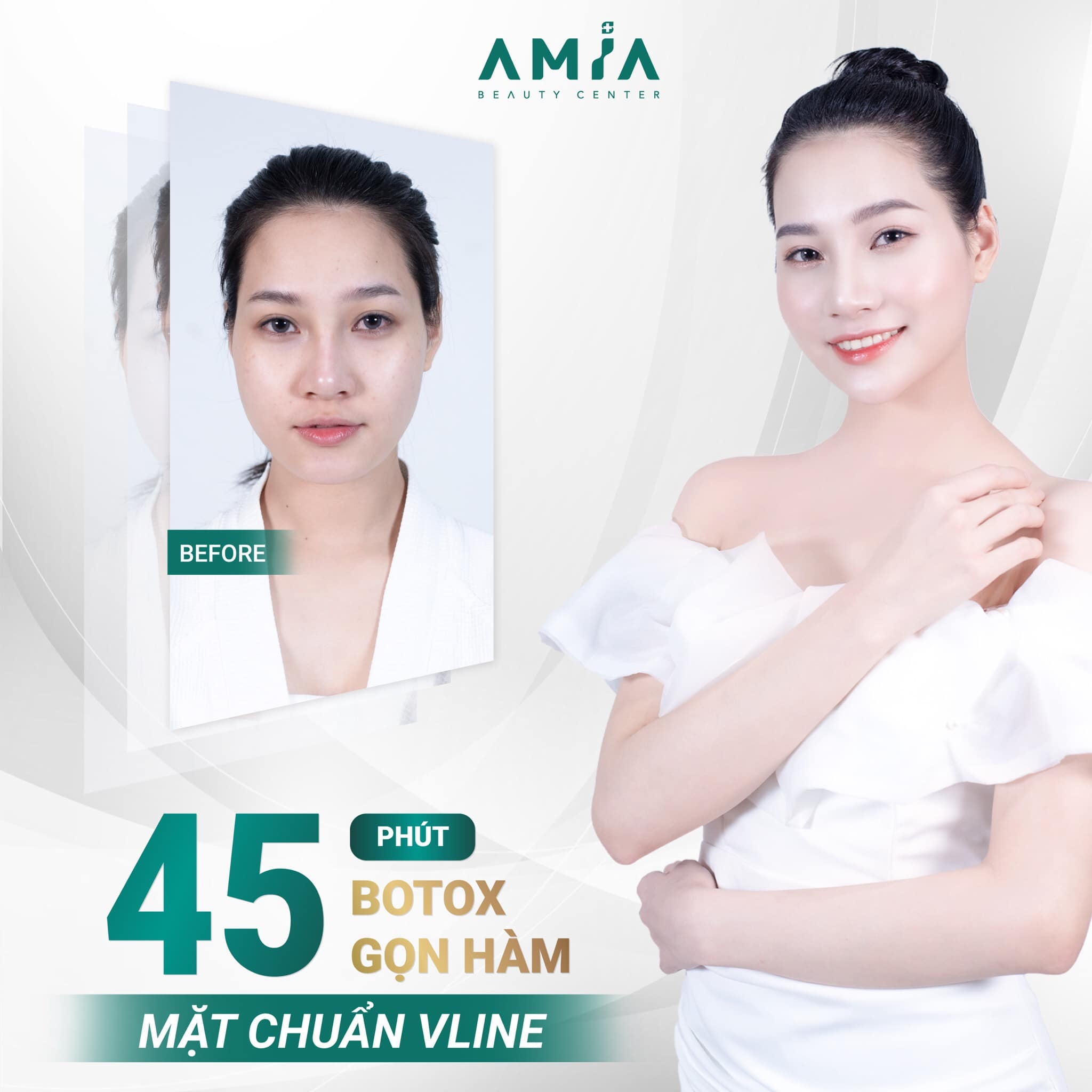 Hình ảnh khách hàng khi tiêm botox tại Amia Beauty Center