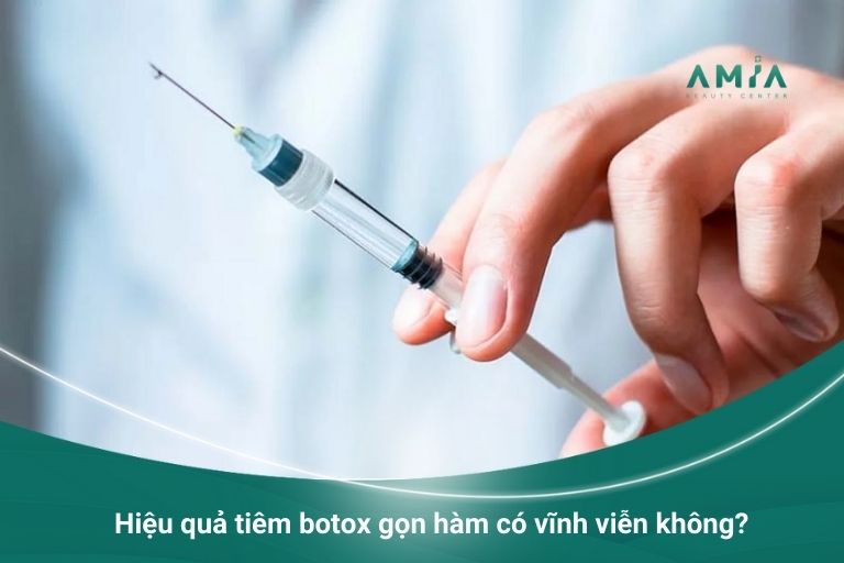 Hiệu quả tiêm botox gọn hàm có vĩnh viễn không?