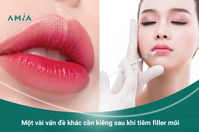 Một vài vấn đề khác cần kiêng sau khi tiêm filler môi