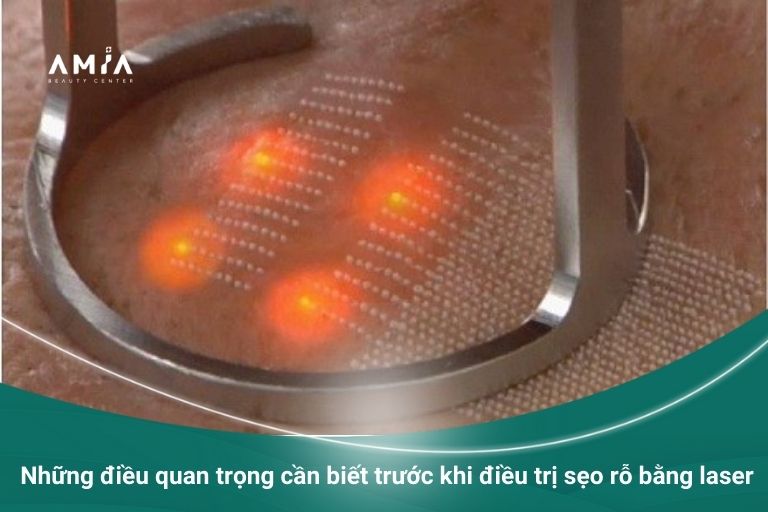 Một số điều quan trọng cần biết trước khi điều trị sẹo 