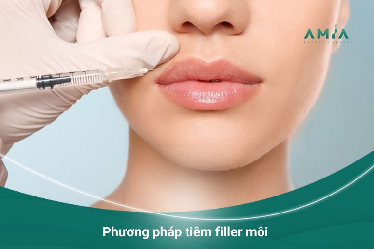 Phương pháp tiêm filler môi làm đẹp nhanh chóng