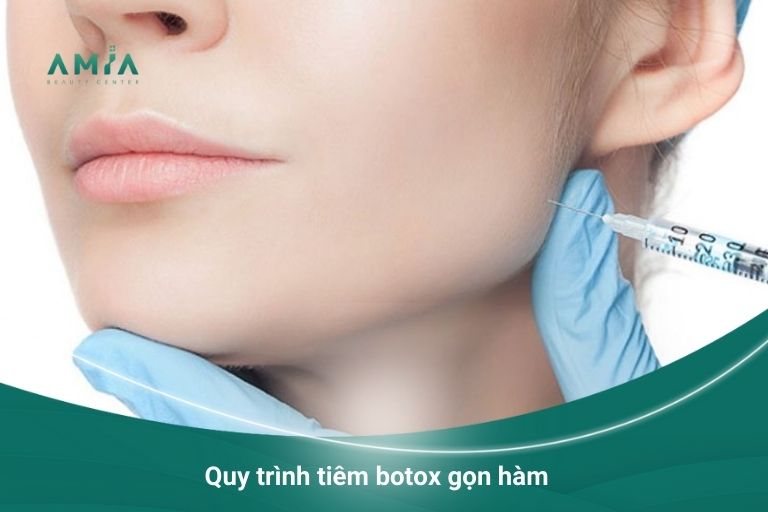 Quy trình tiêm botox gọn hàm