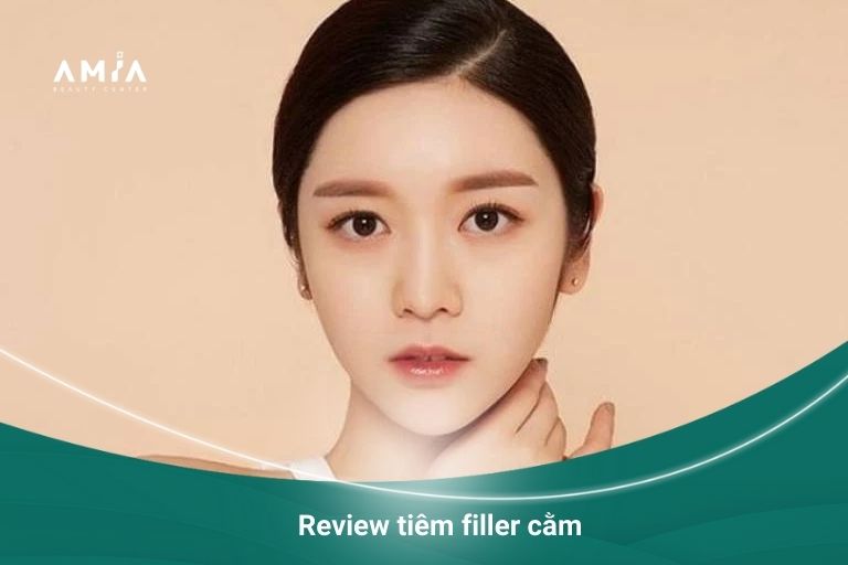 Một số review về phương pháp tiêm filler cằm