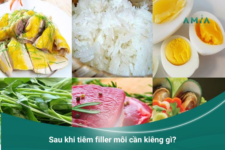 Không nên ăn những món ăn trên sau khi tiêm filler môi