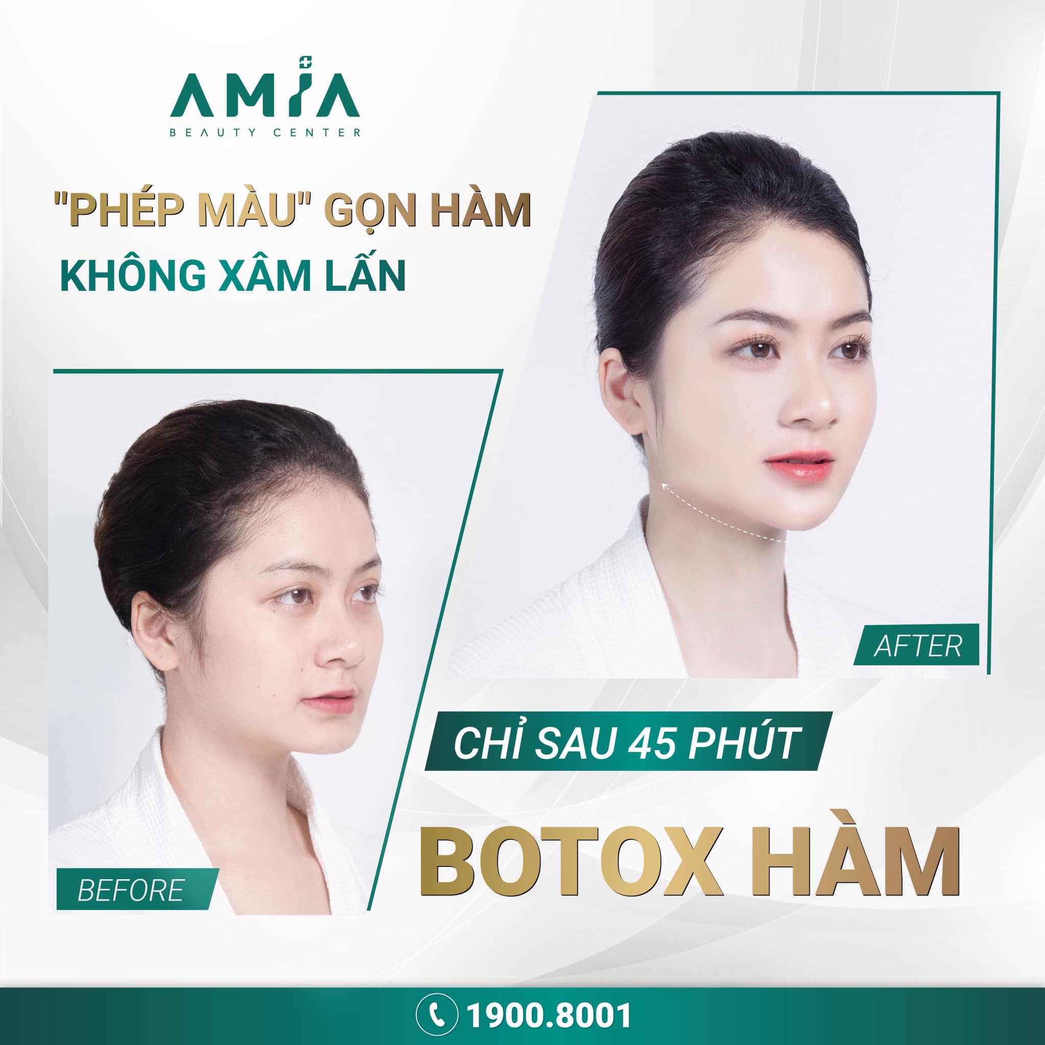 Tiêm botox thon gọn hàm an toàn, hiệu quả dài lâu tại Amia Beauty Center