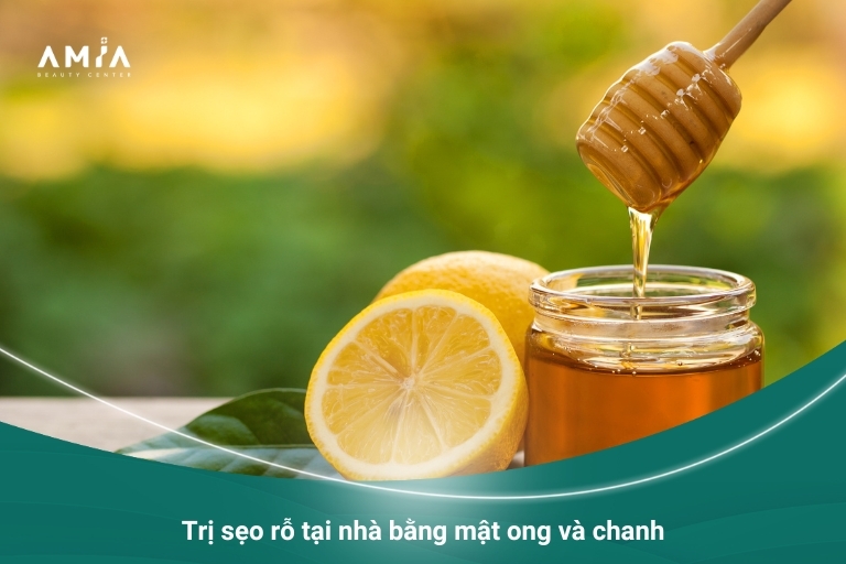 Sử dụng mật ong và chanh để trị sẹo rỗ