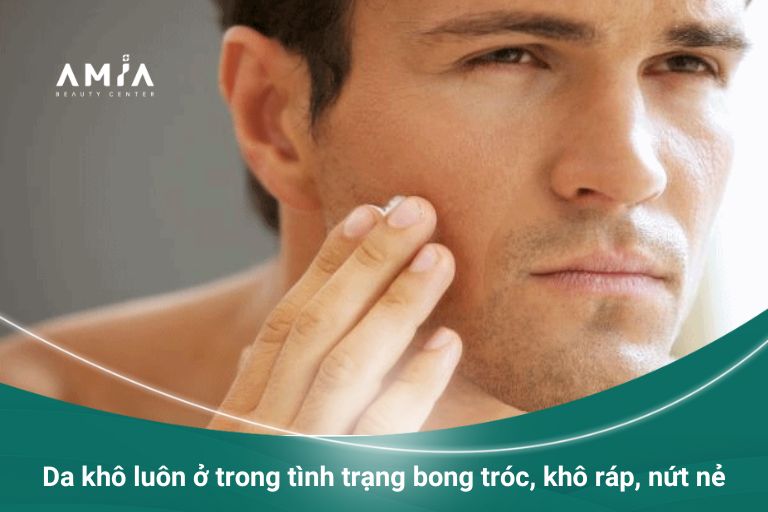 Da khô dễ bị bong tróc vào mùa lạnh