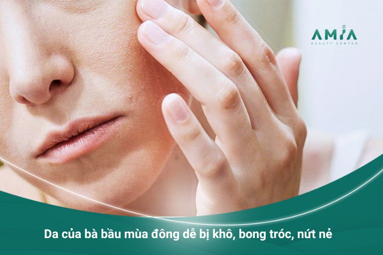 Vào mùa đông da bà bầu thường thay đổi thế nào?