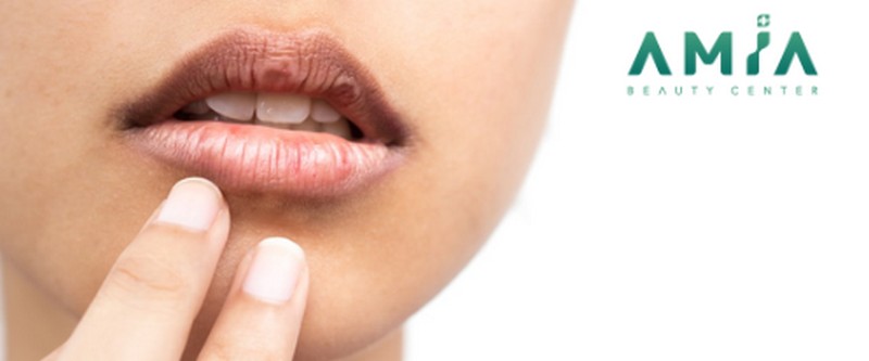 Xăm môi mấy ngày hết sưng? 