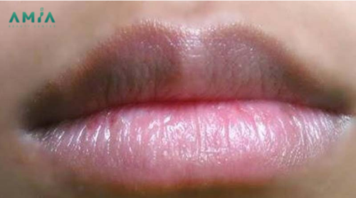 Cách phun môi nhanh bám màu trên môi 