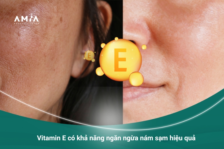 10 cách chăm sóc da với vitamin E có thể bạn chưa biết! Cham-soc-da-voi-vitamin-e-1