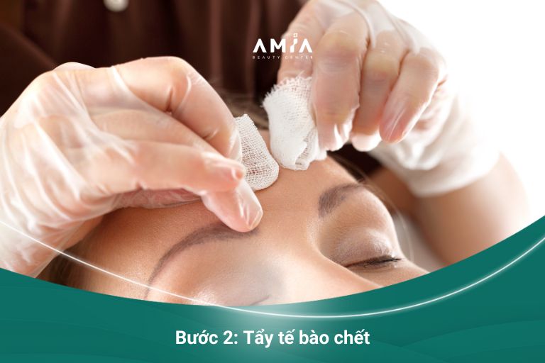 Tẩy tế bào chết - cách chăm sóc da mụn đúng đắn