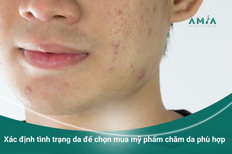 Xác định tình trạng da