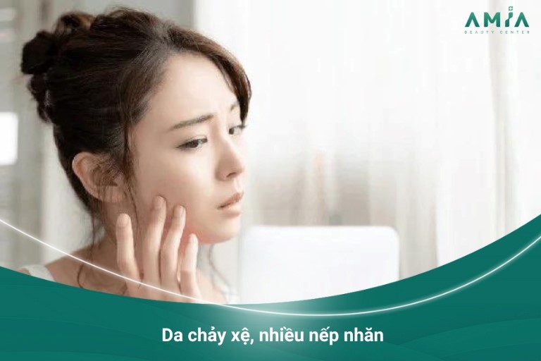 Da chảy xệ, nhiều nếp nhăn