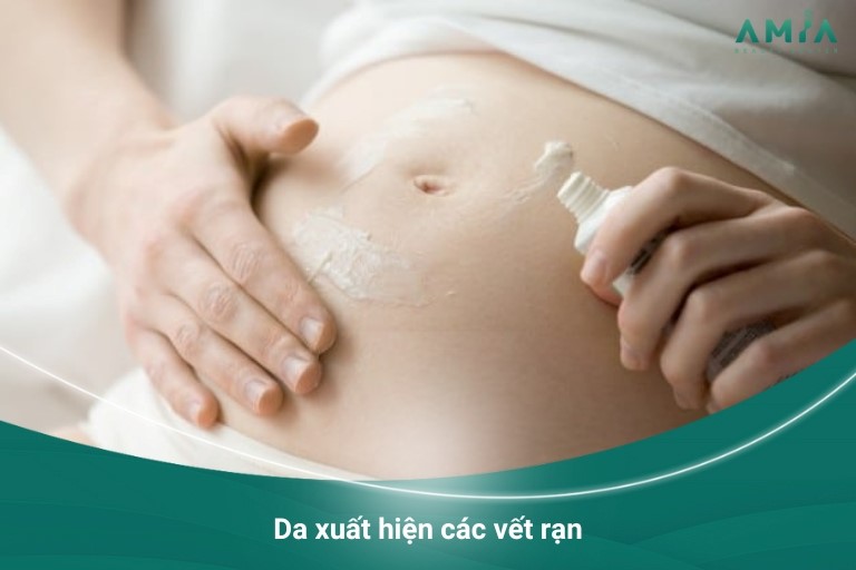 Da xuất hiện các vết rạn