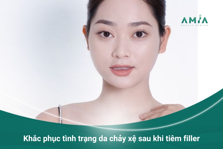 Tác dụng tiêm filler