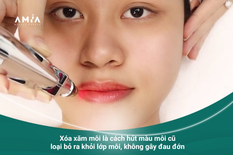 Phương pháp xóa xăm môi bằng laser mới nhất