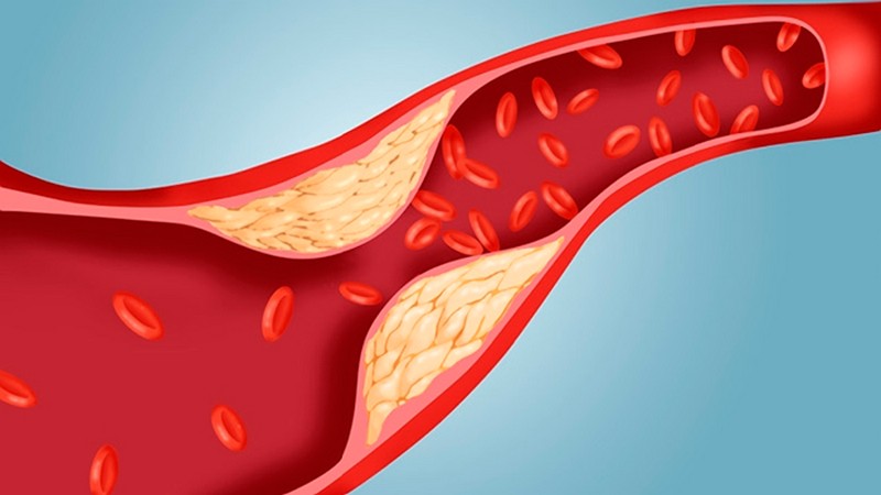 Thay đổi nồng độ cholesterol